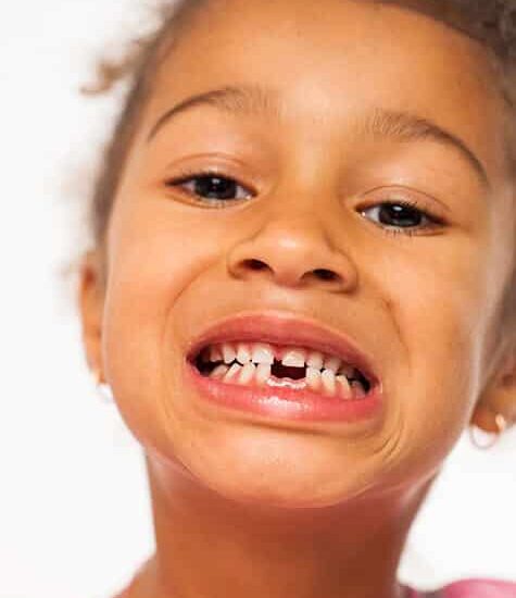 Kid with missing teeth