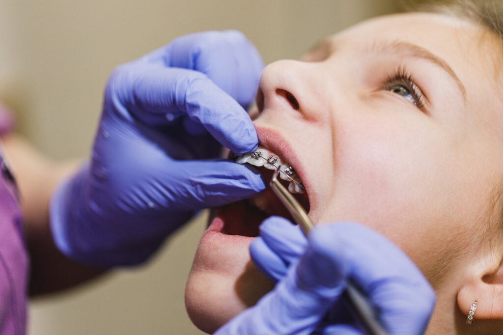 undergoing dental braces