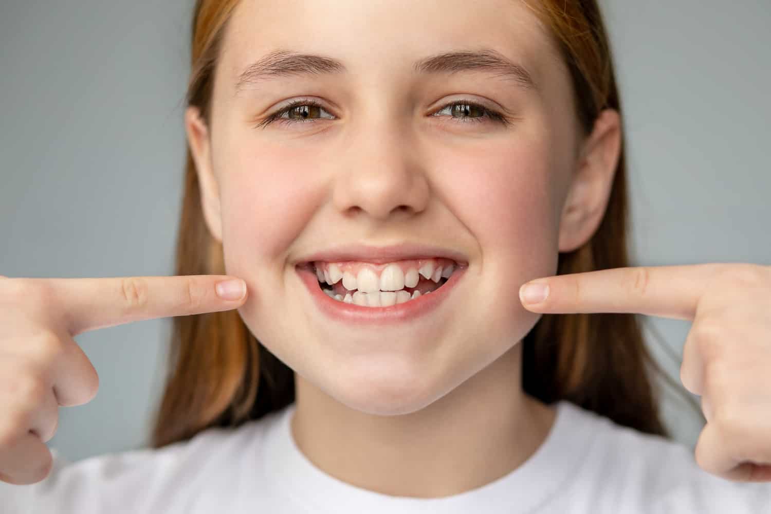 how to fix messed up teeth without braces