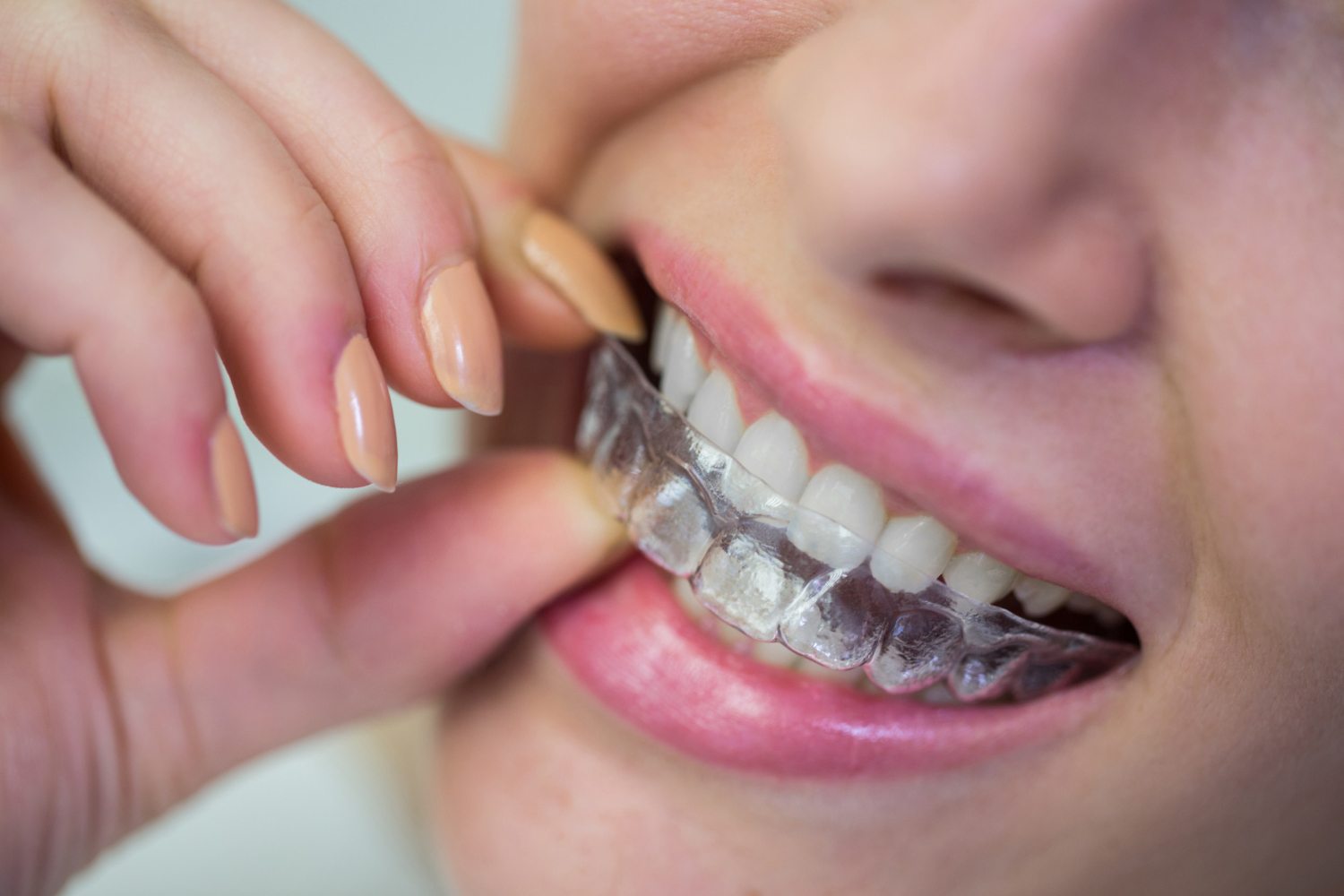 Does Your Invisalign Hurt? Here's How You Can Deal with it.