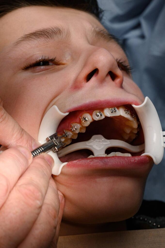 orthodontist fixing broken brackets